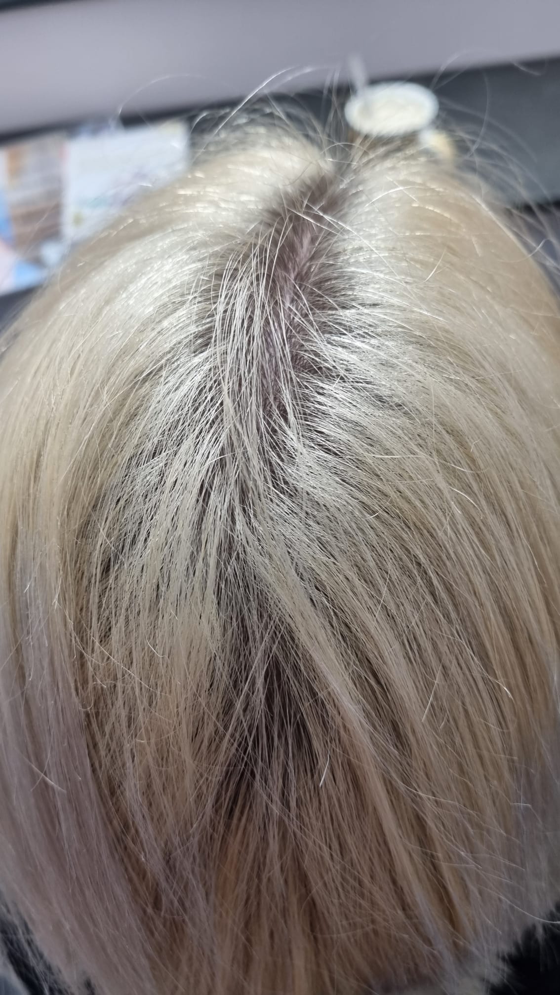 Botox Platinum Bielefeld Vorher – mobile Friseurin Bozena Fuchs
